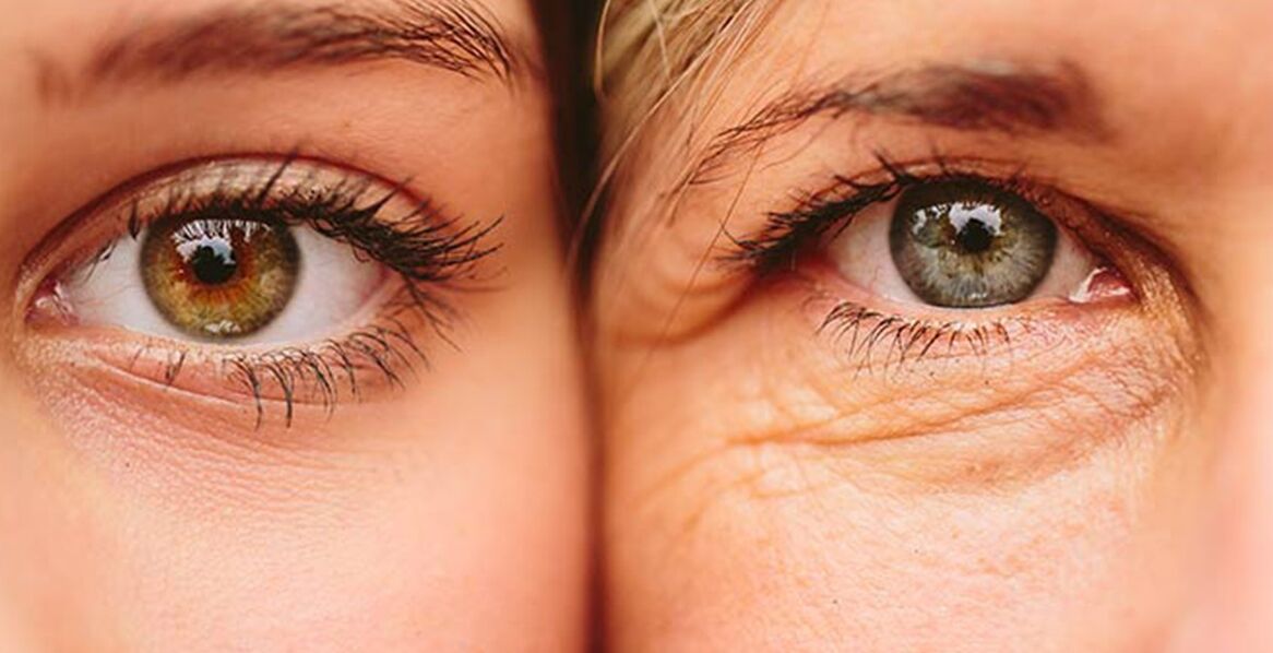 Зовнішні ознаки старіння шкіри навколо очей у двох жінок різного віку